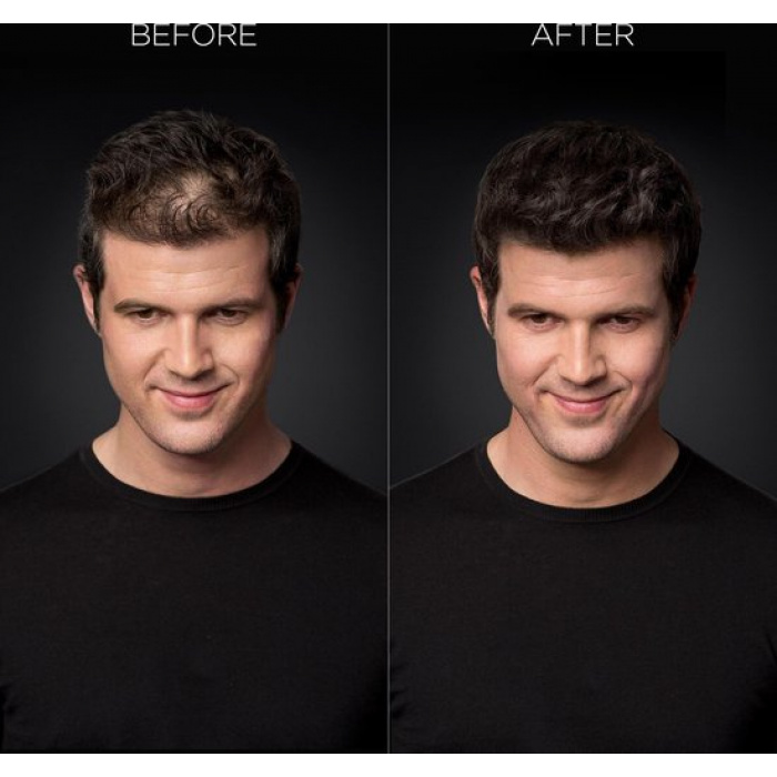 Toppik Colored Hair Thickener Zwart- Haarverdikker Spray - Verbergt haaruitval - Direct voller haar - Afbeelding 2
