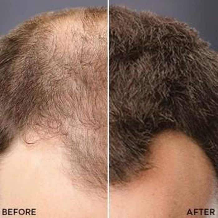 Toppik Colored Hair Thickener Lichtbruin - Haarverdikker Spray - Verbergt haaruitval - Direct voller haar - Afbeelding 4