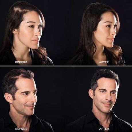 Toppik is een verbazingwekkend product van minuscule haarvezels die zich mengen met je eigen haar. Zonder dat dit zichtbaar is. Toppik haarvezels zijn gemaakt van organische Keratine proteïnen, net als je eigen haar. Je ziet direct dat het haar veel voller wordt, veel natuurlijker dan je zou kunnen bedenken. Dikker haar en meer zelfvertouwen Toppik is heel eenvoudig aan te brengen door de flacon boven het dunne deel van je haar te houden en dan lichtjes te schudden. In seconden zullen duizenden minuscule haarvezels, in jouw haarkleur, zich mengen met je eigen haar. Door middel van statische electriciteit hechten de vezeltjes zich aan het haar zodat ze op hun plaats blijven, Na het aanbrengen even lichtjes kloppen met je vingertoppen om de vezels goed te verdelen. Met de Toppik Fiberhold Spray zorg je ervoor dat de haarvezels op hun plek blijven in wind, regen en tijdens het sporten. Toppik blijft de gehele dag perfect zitten, geeft niet af, schilfert en irriteert niet en is na fixatie bestand tegen wind, regen en transpiratie. Bovendien is Toppik makkelijk te verwijderen door je haar te wassen met een willekeurige shampoo. Gebruik de Toppik Spray Applicator en Toppik Hairline Optimizer voor een 100% natuurlijk en perfect resultaat. STAP VOOR STAP Droog en style je haar als gewoonlijk. Schud de Toppik haarvezels op het gebied waar het haar dunner is. Klop zachtjes op je hoofd om de vezels de verdelen. Breng de Toppik Fiberholdspray aan. Indien gewenst, kam of borstel je haar na het aanbrengen van Toppik haarvezels.