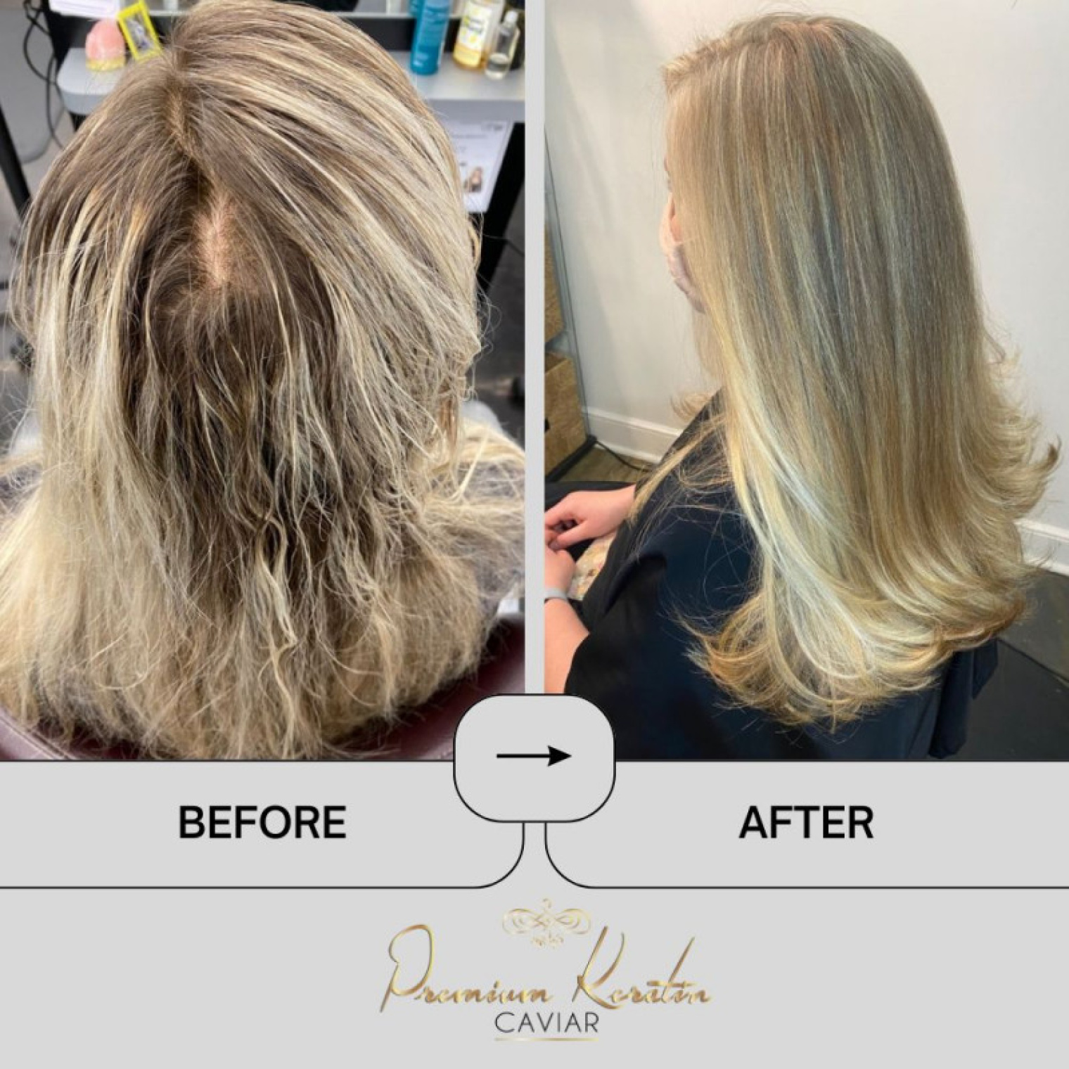 EM2H Premium Keratin Caviar Intensive Kit is een Keratine behandeling wat pluizend en beschadigd haar repareert. Als jij last hebt van beschadigd haar, dan is deze keratine behandeling speciaal voor jou weggelegd. Beschadiging van het haar komt vooral door het verven, föhnen en het gebruik van stijltangen. EM2H Premium Keratin Caviar Intensive Kit is speciaal ontworpen om te hydrateren, te voeden en bevordert het herstel van het haar. Deze keratine behandeling maakt het haar gezond, zacht, glad en laat het stralen als nooit te voren! flaka.be