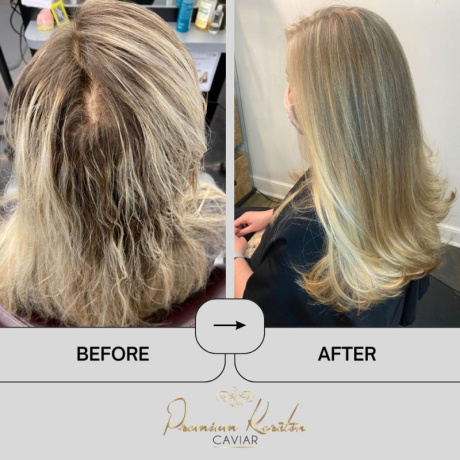 EM2H Premium Keratin Caviar Intensive Kit is een Keratine behandeling wat pluizend en beschadigd haar repareert. Als jij last hebt van beschadigd haar, dan is deze keratine behandeling speciaal voor jou weggelegd. Beschadiging van het haar komt vooral door het verven, föhnen en het gebruik van stijltangen. EM2H Premium Keratin Caviar Intensive Kit is speciaal ontworpen om te hydrateren, te voeden en bevordert het herstel van het haar. Deze keratine behandeling maakt het haar gezond, zacht, glad en laat het stralen als nooit te voren! flaka.be